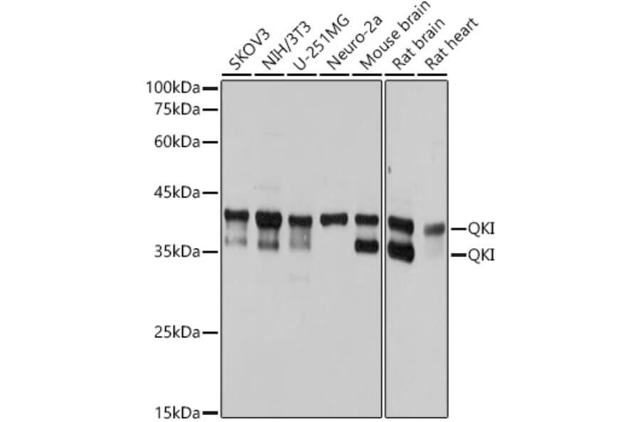 Western Blot - Anti-QKI Antibody [ARC2500] (A8374) - Antibodies.com