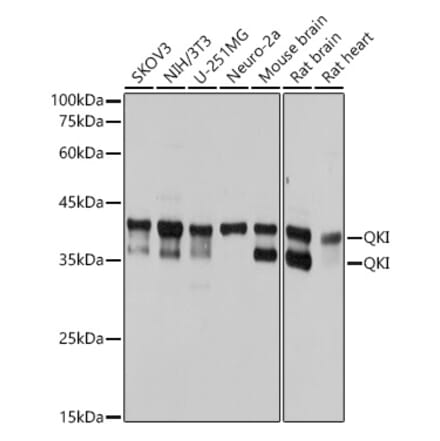 Western Blot - Anti-QKI Antibody [ARC2500] (A8374) - Antibodies.com