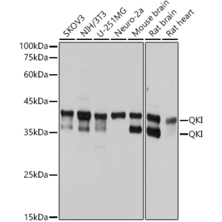 Western Blot - Anti-QKI Antibody [ARC2500] (A8374) - Antibodies.com