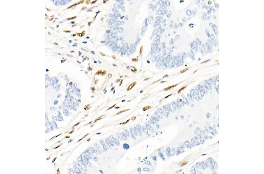 Immunohistochemistry - Anti-QKI Antibody [ARC2500] (A8374) - Antibodies.com