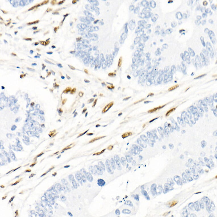 Immunohistochemistry - Anti-QKI Antibody [ARC2500] (A8374) - Antibodies.com