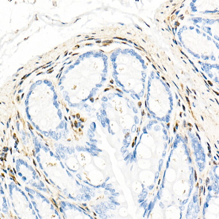 Immunohistochemistry - Anti-QKI Antibody [ARC2500] (A8374) - Antibodies.com