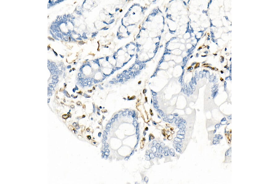 Immunohistochemistry - Anti-QKI Antibody [ARC2500] (A8374) - Antibodies.com