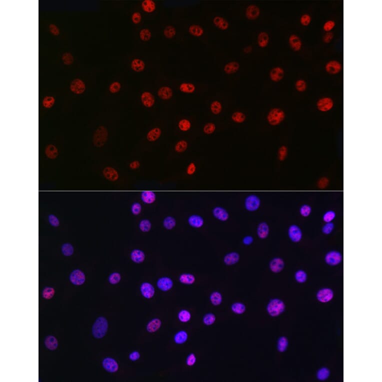 Immunofluorescence - Anti-QKI Antibody [ARC2500] (A8374) - Antibodies.com