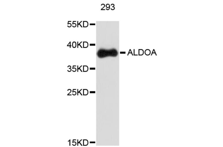 Western Blot - Anti-ALDOA Antibody (A0195) - Antibodies.com