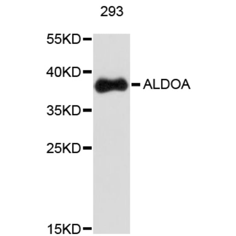 Western Blot - Anti-ALDOA Antibody (A0195) - Antibodies.com