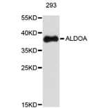 Western Blot - Anti-ALDOA Antibody (A0195) - Antibodies.com