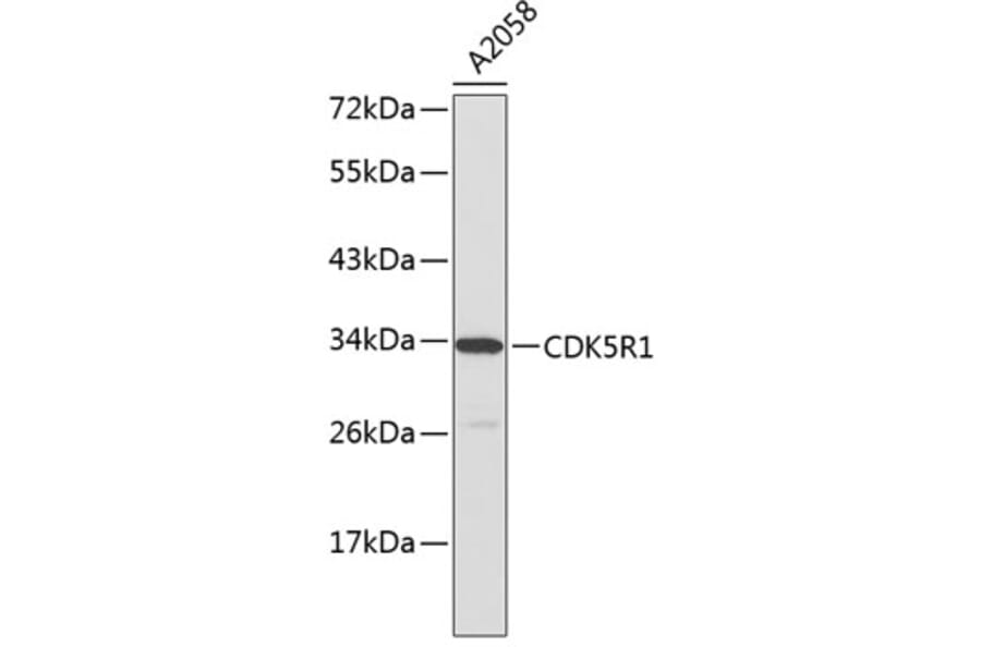 Western Blot - Anti-CDK5R1 Antibody (A0197) - Antibodies.com