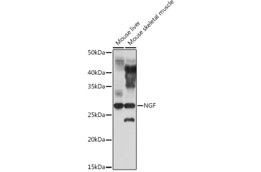 Western Blot - Anti-NGF Antibody (A8378) - Antibodies.com