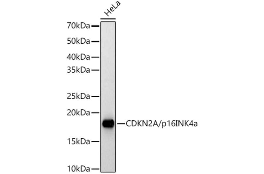 Western Blot - Anti-CDKN2A/p16INK4aF Antibody (A8379) - Antibodies.com