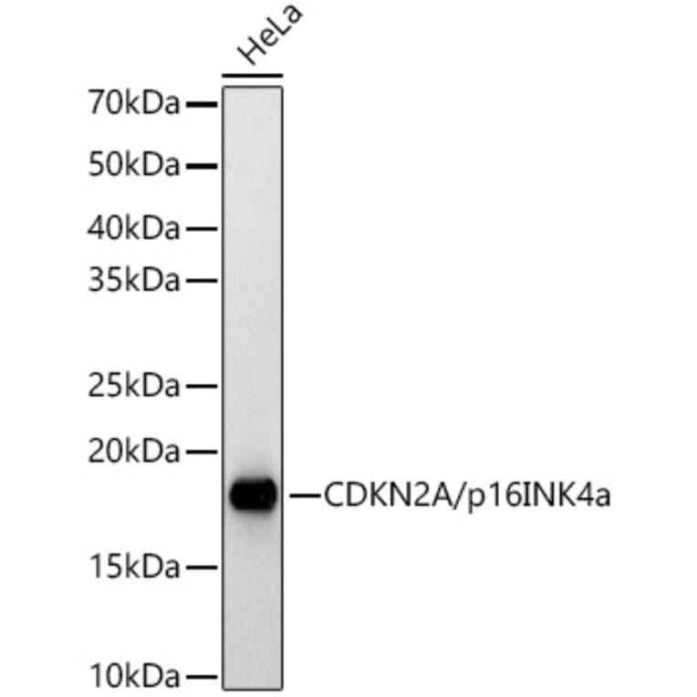 Western Blot - Anti-CDKN2A/p16INK4aF Antibody (A8379) - Antibodies.com