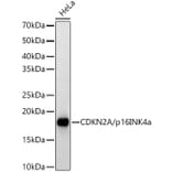 Western Blot - Anti-CDKN2A/p16INK4aF Antibody (A8379) - Antibodies.com