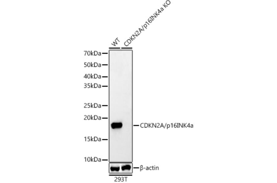 Western Blot - Anti-CDKN2A/p16INK4aF Antibody (A8379) - Antibodies.com