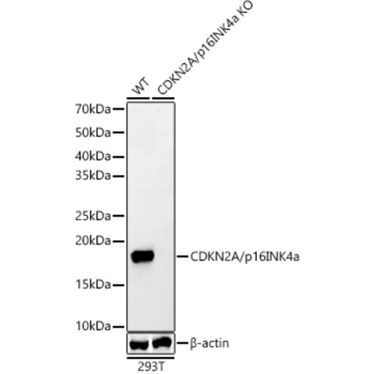 Western Blot - Anti-CDKN2A/p16INK4aF Antibody (A8379) - Antibodies.com