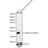 Western Blot - Anti-CDKN2A/p16INK4aF Antibody (A8379) - Antibodies.com
