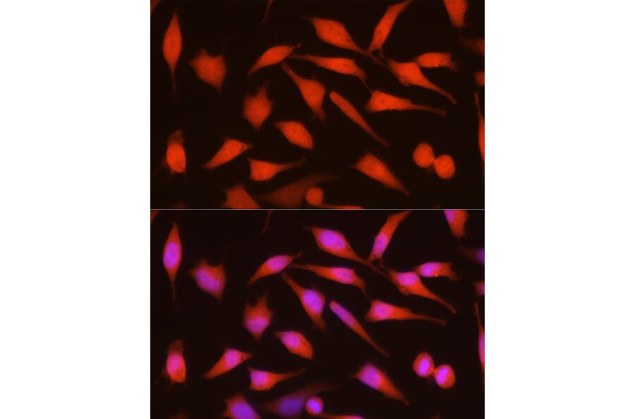 Immunofluorescence - Anti-CDKN2A/p16INK4aF Antibody (A8379) - Antibodies.com