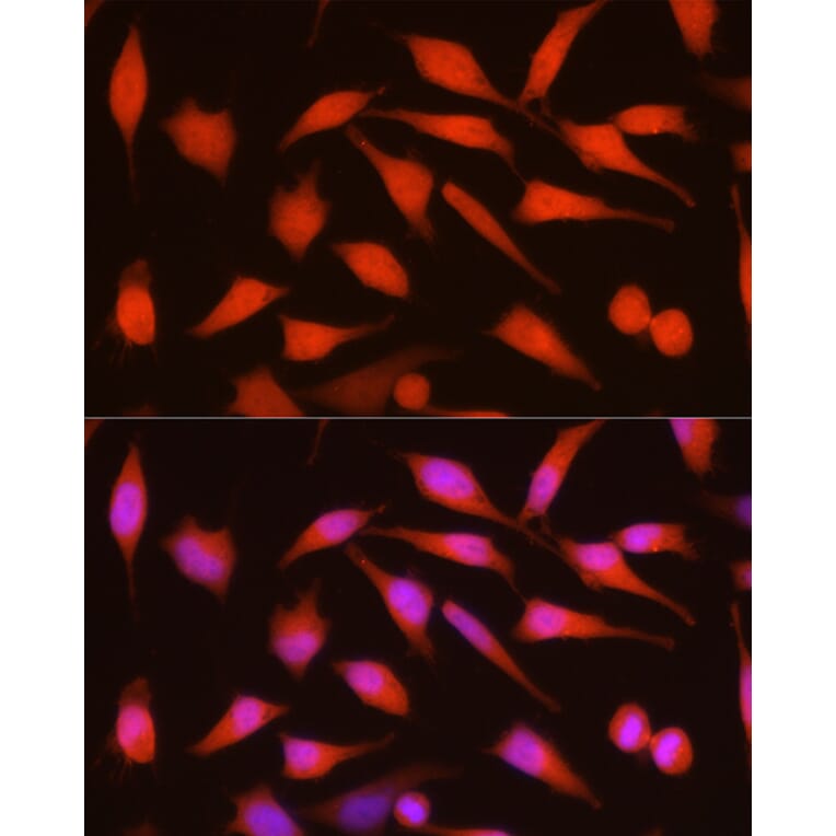 Immunofluorescence - Anti-CDKN2A/p16INK4aF Antibody (A8379) - Antibodies.com