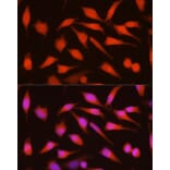 Immunofluorescence - Anti-CDKN2A/p16INK4aF Antibody (A8379) - Antibodies.com
