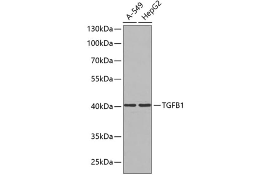 Western Blot - Anti-TGFB1 Antibody (A0291) - Antibodies.com
