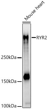 Western blot analysis of extracts of mouse heart, using Anti-RYR2 Antibody (A0298) at 1:3000 dilution.
Secondary antibody: Goat Anti-Rabbit IgG (H+L) (HRP) (AS014) at 1:10,000 dilution.
Lysates / proteins: 25µg per lane.
Blocking buffer: 3% non-fat dry milk in TBST.
Detection: ECL Enhanced Kit (RM00021).
Exposure time: 90s.