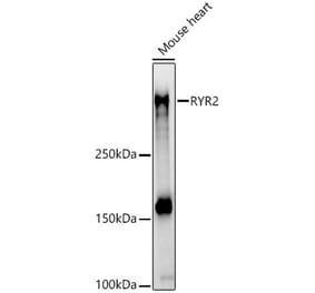 Western Blot - Anti-Ryanodine Receptor Antibody (A8382) - Antibodies.com