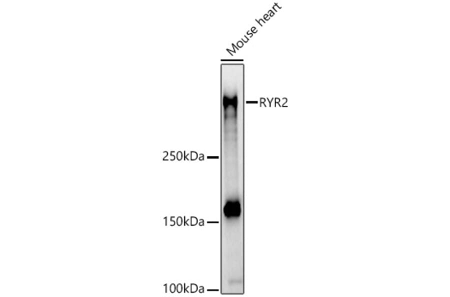 Western Blot - Anti-Ryanodine Receptor Antibody (A8382) - Antibodies.com