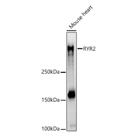 Western Blot - Anti-Ryanodine Receptor Antibody (A8382) - Antibodies.com