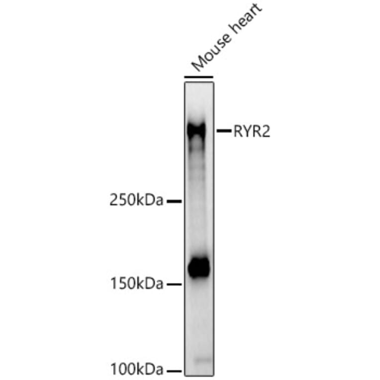 Western Blot - Anti-Ryanodine Receptor Antibody (A8382) - Antibodies.com