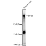 Western Blot - Anti-Ryanodine Receptor Antibody (A8382) - Antibodies.com