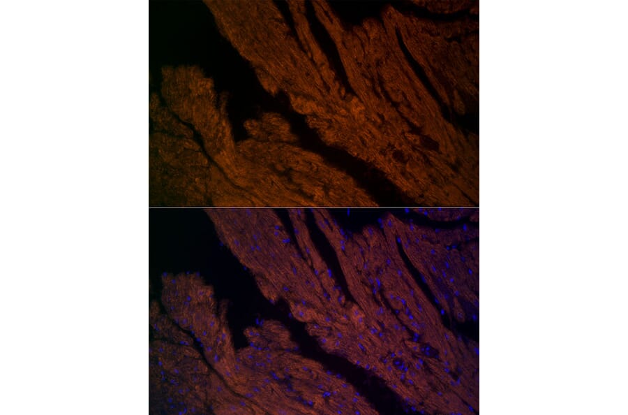Immunofluorescence - Anti-Ryanodine Receptor Antibody (A8382) - Antibodies.com