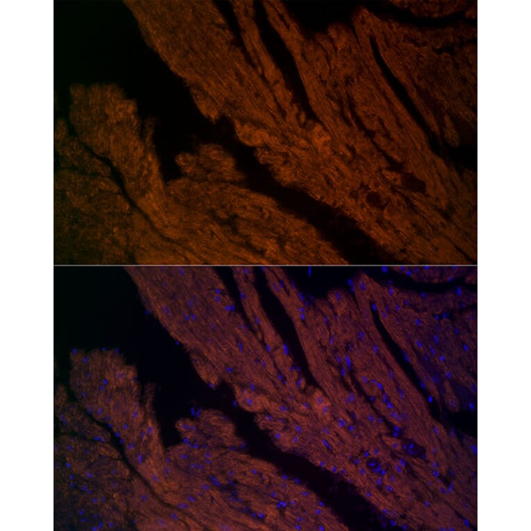 Immunofluorescence - Anti-Ryanodine Receptor Antibody (A8382) - Antibodies.com