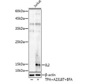 Western Blot - Anti-IL-2 Antibody (A8383) - Antibodies.com