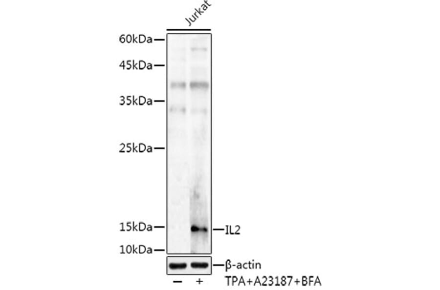 Western Blot - Anti-IL-2 Antibody (A8383) - Antibodies.com
