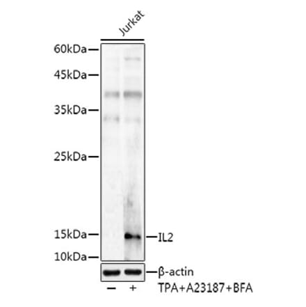 Western Blot - Anti-IL-2 Antibody (A8383) - Antibodies.com