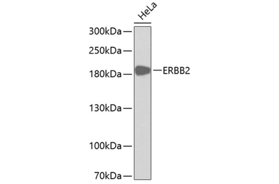 Western Blot - Anti-ERBB2 Antibody (A0306) - Antibodies.com