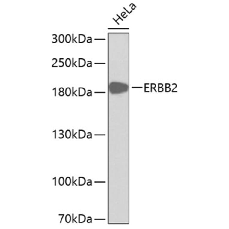 Western Blot - Anti-ERBB2 Antibody (A0306) - Antibodies.com
