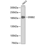 Western Blot - Anti-ERBB2 Antibody (A0306) - Antibodies.com