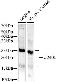 Western blot analysis of extracts of various cell lines, using Anti-CD40LG Antibody (A0327) at 1:1,000 dilution.
Secondary antibody: Goat Anti-Rabbit IgG (H+L) (HRP) (AS014) at 1:10,000 dilution.
Lysates / proteins: 25µg per lane.
Blocking buffer: 3% non-fat dry milk in TBST.