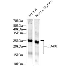 Western Blot - Anti-TNFSF5 Antibody (A8386) - Antibodies.com