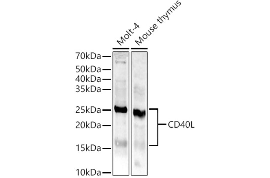 Western Blot - Anti-TNFSF5 Antibody (A8386) - Antibodies.com