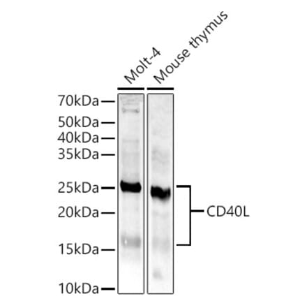 Western Blot - Anti-TNFSF5 Antibody (A8386) - Antibodies.com