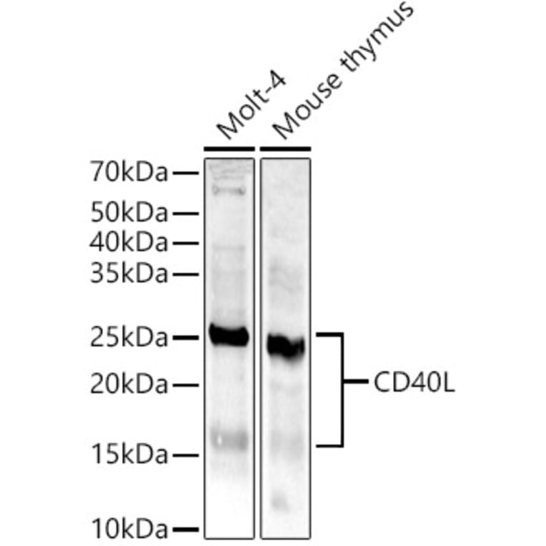 Western Blot - Anti-TNFSF5 Antibody (A8386) - Antibodies.com