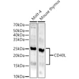 Western Blot - Anti-TNFSF5 Antibody (A8386) - Antibodies.com