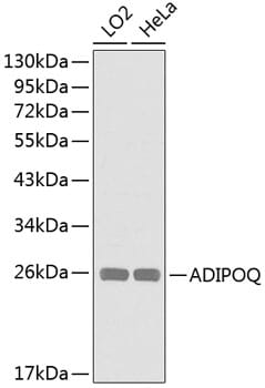 Western blot analysis of extracts of various cell lines, using Anti-ADIPOQ Antibody (A0328).
Secondary antibody: Goat Anti-Rabbit IgG (H+L) (HRP) (AS014) at 1:10,000 dilution.
Lysates / proteins: 25µg per lane.
Blocking buffer: 3% non-fat dry milk in TBST.