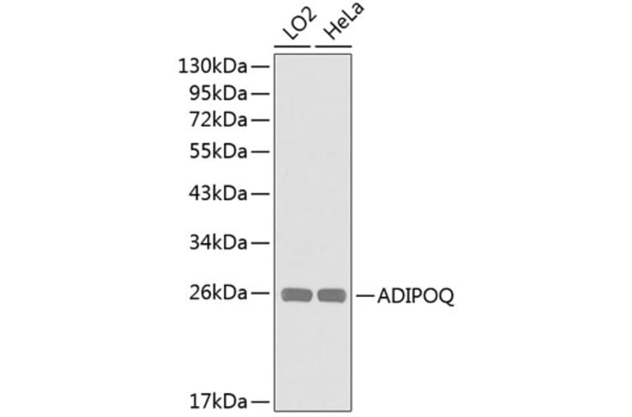 Western Blot - Anti-ADIPOQ Antibody (A0328) - Antibodies.com