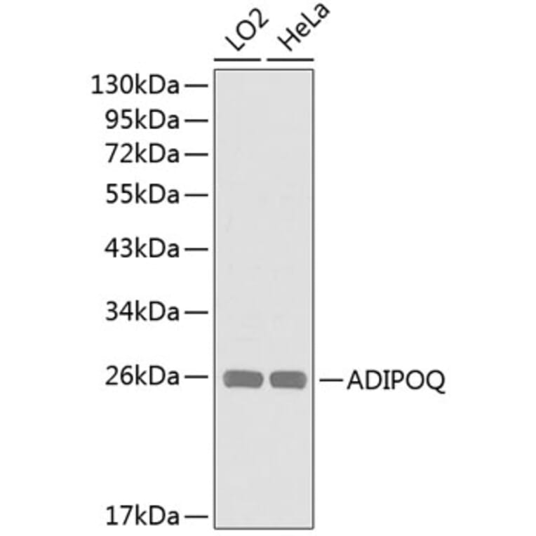Western Blot - Anti-ADIPOQ Antibody (A0328) - Antibodies.com