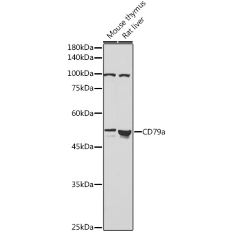 Western Blot - Anti-CD79a Antibody (A8388) - Antibodies.com