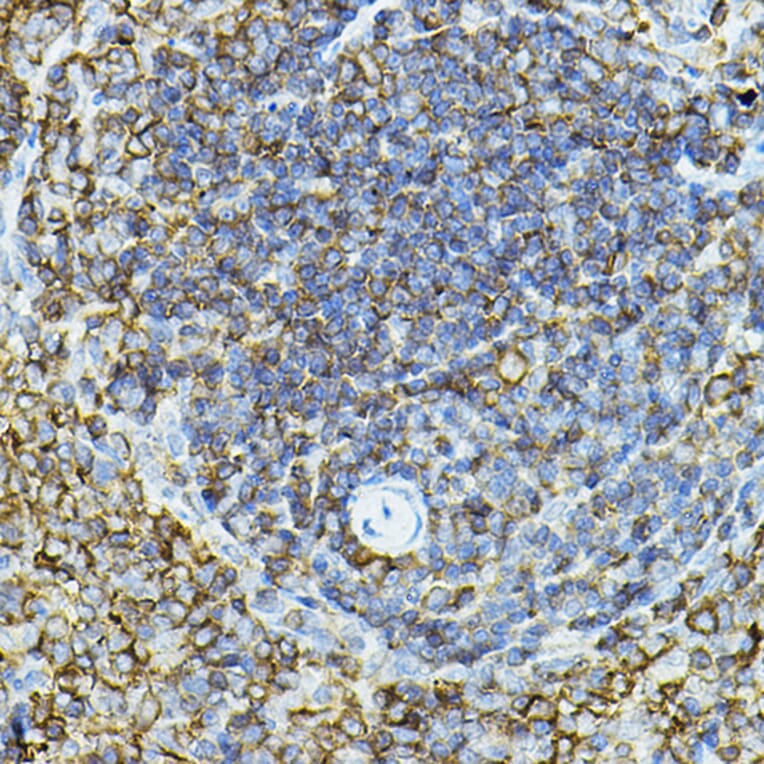 Immunohistochemistry - Anti-CD79a Antibody (A8388) - Antibodies.com
