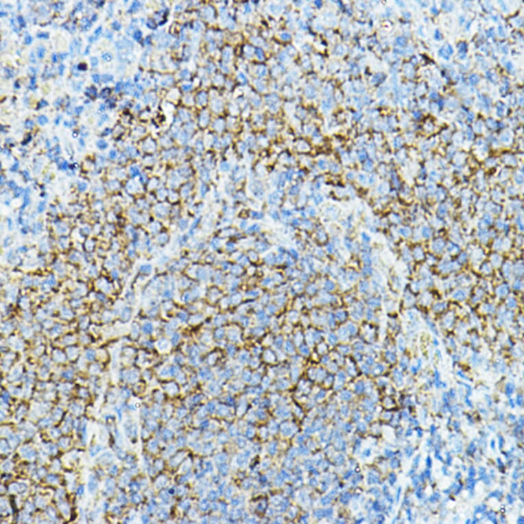 Immunohistochemistry - Anti-CD79a Antibody (A8388) - Antibodies.com