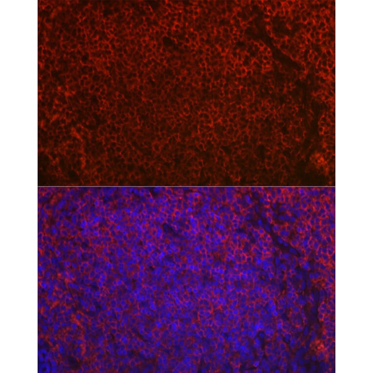 Immunofluorescence - Anti-CD79a Antibody (A8388) - Antibodies.com
